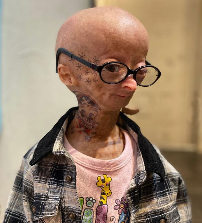 Adalia Rose Wiki, Death, Age, Height, Boyfriend, Family, Biography & More - Famous People Wiki