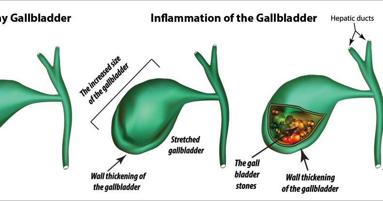 Healthy Gallbladder